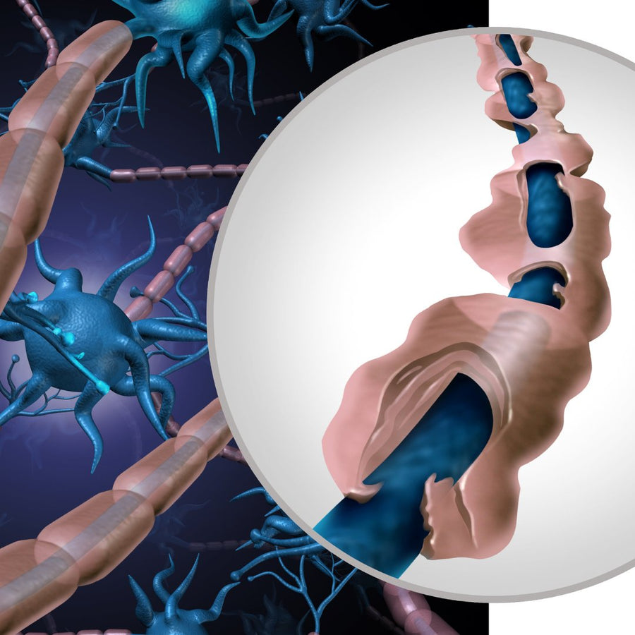 MS - Multiple Sclerosis -old