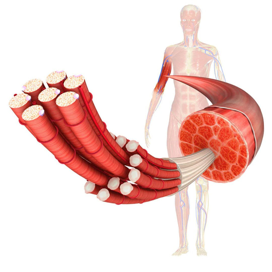 MD - Muscular Dystrophy